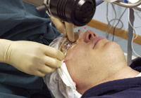 LASIK | Photorefractive Keratectomy (PRK) Surgery | Port Huron